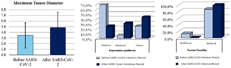 Immunohistochemical Evaluation of SARS-CoV-2 Nucleoprotein and ACE2 Markers in Testicular Tumors Diagnosed During the COVID-19 Pandemic.