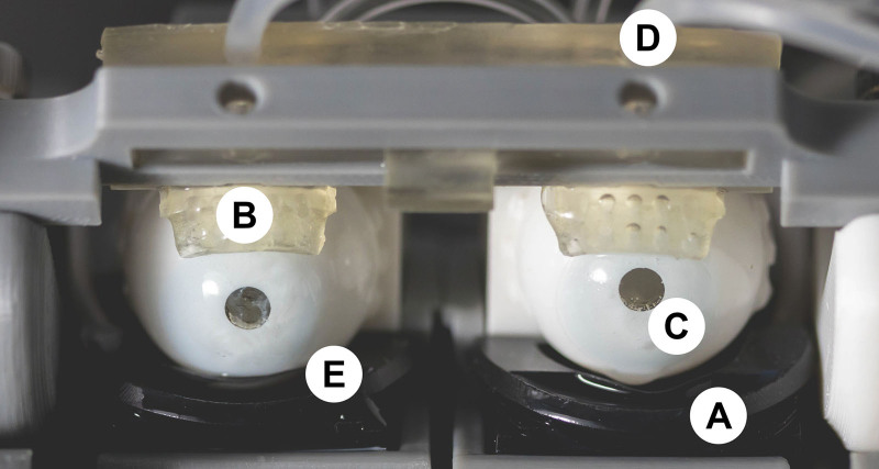 Evaluating the initial and end-of-day wettability of contemporary daily disposable contact lenses using various in vitro methods.