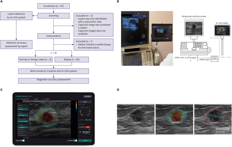 Efficacy of a Real-Time Artificial Intelligence Ultrasound System With Computer-Aided Detection and Diagnosis for Breast Cancer: A Feasibility Study.