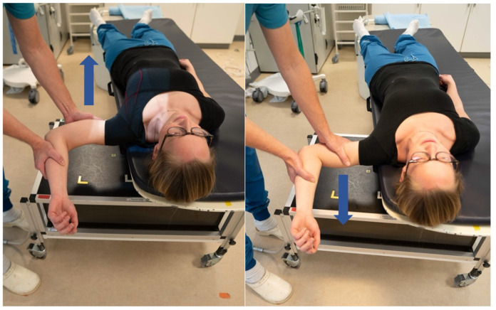 One-year follow-up of 20 patients undergoing the Latarjet procedure : a biomechanical study during an apprehension-relocation test measured with radiostereometry.