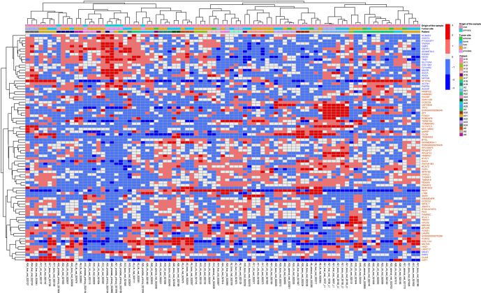 Identification of protein-coding genes associated with metastatic prostate cancer.