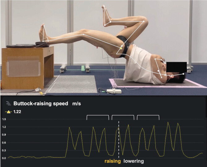 Evaluating the optimal height for hamstring activity in the maximum-speed single-leg bridge test.