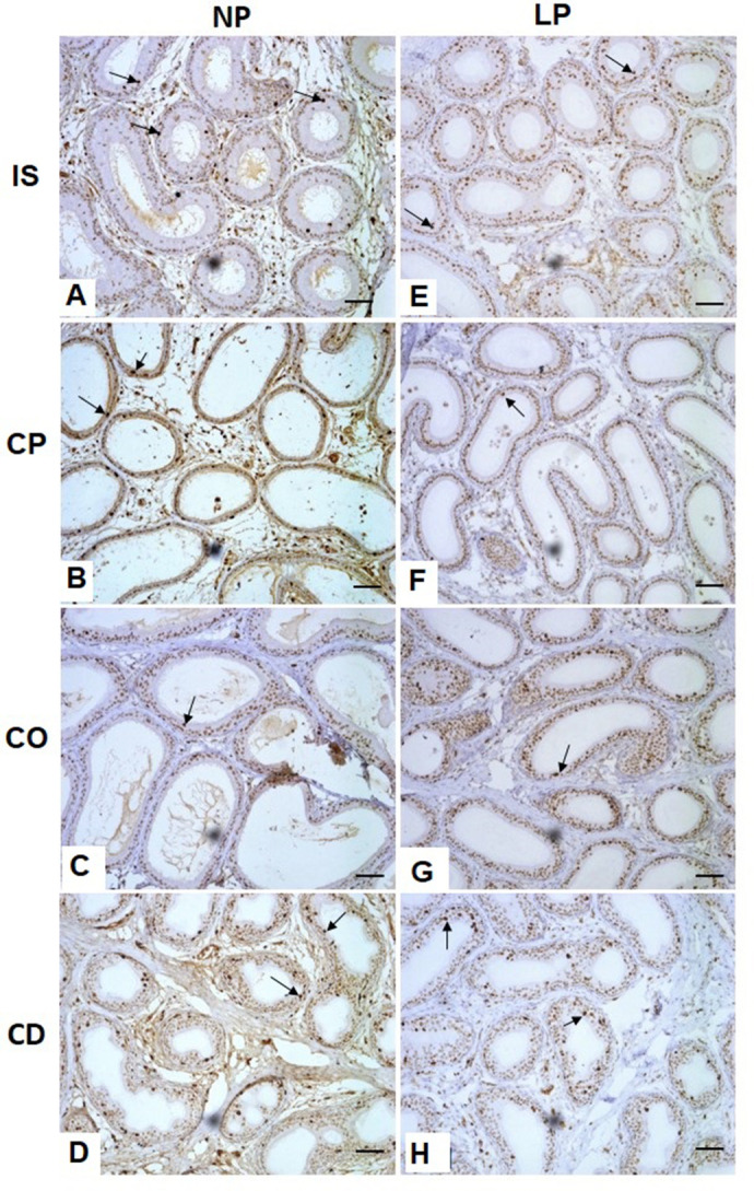Maternal protein restriction affects the differentiation of cells in the epididymal epithelium lining of 44-day-old rats.