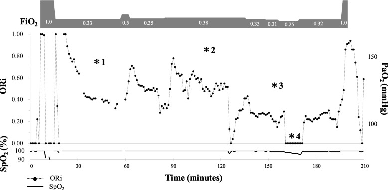 Relationship between the updated oxygen reserve index and arterial partial pressure of oxygen: a prospective observational study.