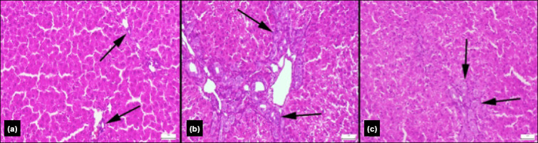 The effects of rose oil on liver damage in an experimental model of obstructive jaundice.