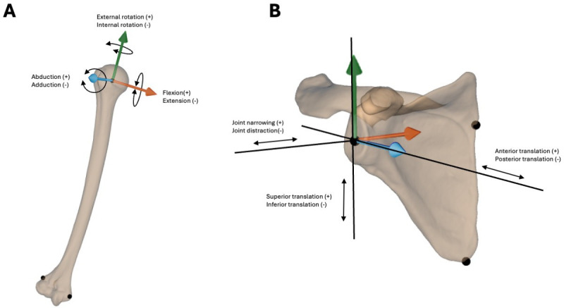 One-year follow-up of 20 patients undergoing the Latarjet procedure : a biomechanical study during an apprehension-relocation test measured with radiostereometry.