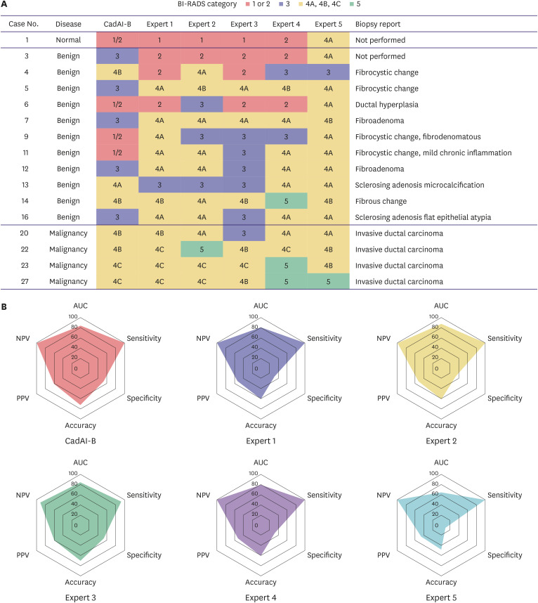 Efficacy of a Real-Time Artificial Intelligence Ultrasound System With Computer-Aided Detection and Diagnosis for Breast Cancer: A Feasibility Study.
