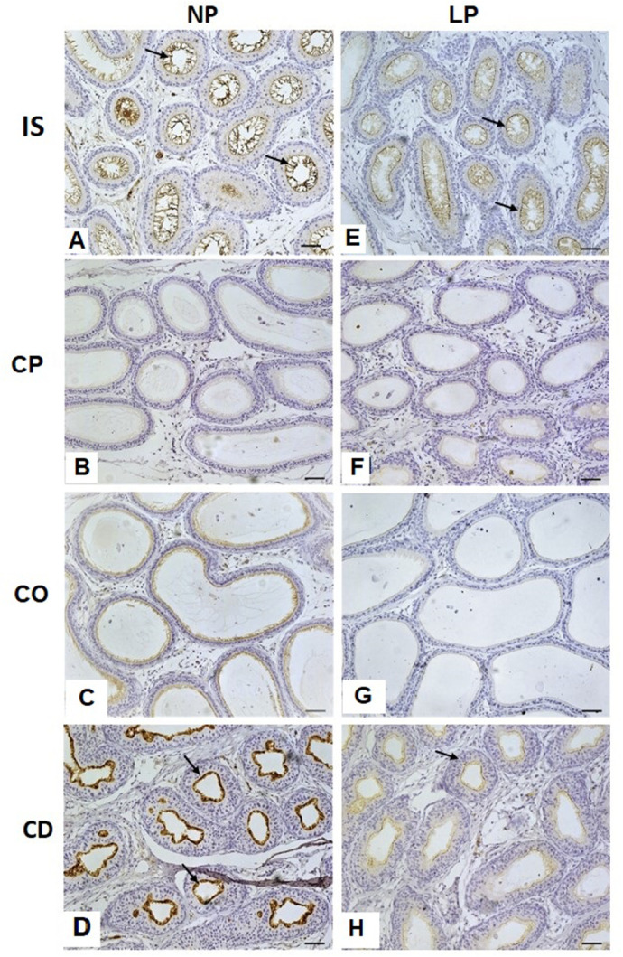 Maternal protein restriction affects the differentiation of cells in the epididymal epithelium lining of 44-day-old rats.