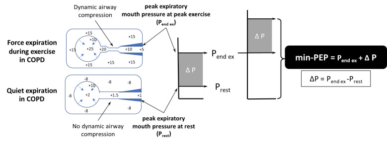 Influence of conical-PEP breathing on exercise performance in patients with chronic obstructive pulmonary disease: A single-blind randomized crossover trial.