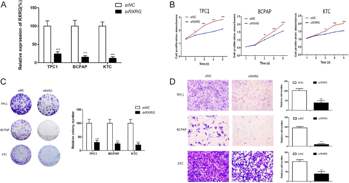 Retinoid X receptor γ regulates epithelial-mesenchymal transition and tumor immune infiltration in papillary thyroid cancer tumorigenesis: an experimental and in silico study.