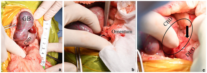 Choledochoduodenostomy in a cat with extrahepatic biliary obstruction: simple side-to-side anastomosis technique.