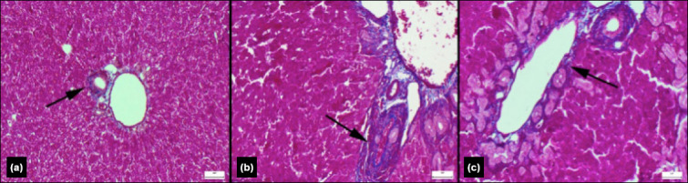 The effects of rose oil on liver damage in an experimental model of obstructive jaundice.