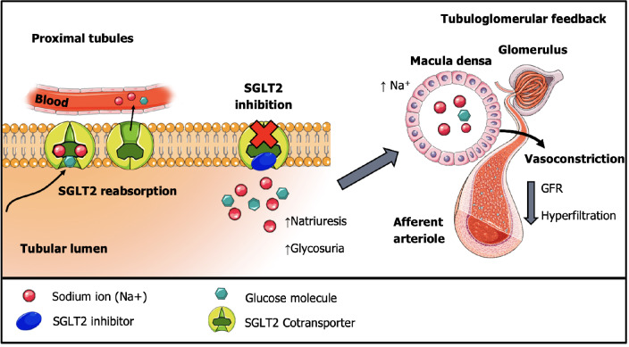Beyond glycemic control: Roles for sodium-glucose cotransporter 2 inhibitors and glucagon-like peptide-1 receptor agonists in diabetic kidney disease.