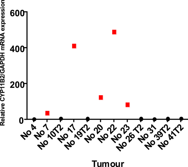 Intratumoural aldosterone and CYP11B2 expression levels among different genotypes of aldosterone producing tumours.
