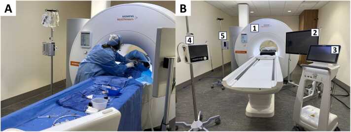 Feasibility of magnetic resonance imaging-guided cardiac catheterization, angioplasty, and stenting in a commercial wide-bore 0.55T scanner.