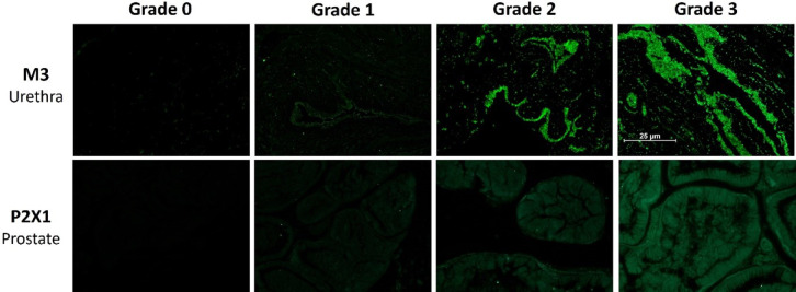 Induction of chronic prostatitis does not alter the innate contractile properties of the prostate or urethra in rats.