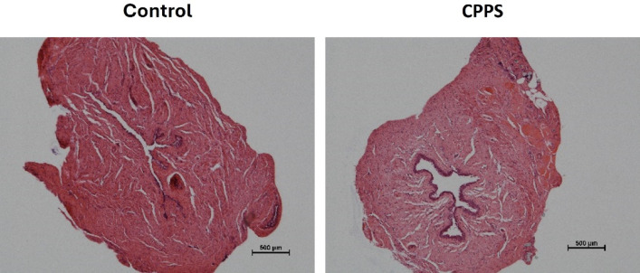 Induction of chronic prostatitis does not alter the innate contractile properties of the prostate or urethra in rats.
