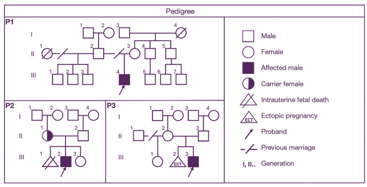 Cardiac arrhythmia, developmental delay, epilepsy and ichthyosis due to Xp22.31 deletion: review of literature and case report.