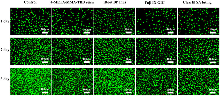 Laboratory study on reattachment of vertical root fractures using 4-META/MMA-TBB resin.