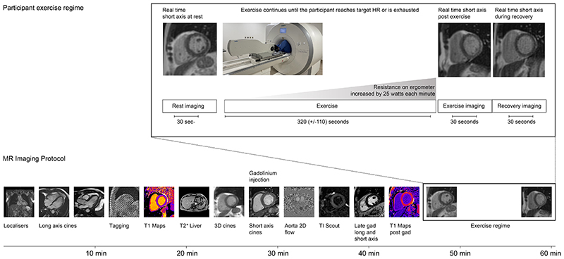 Establishing Cardiac MRI Reference Ranges Stratified by Sex and Age for Cardiovascular Function during Exercise.