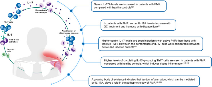 The Impact of IL-17A Inhibition in Rheumatic and Musculoskeletal Diseases: Current Insights and Future Prospects.