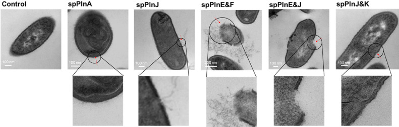 Synthetic Plantaricins Derived from <i>Lactiplantibacillus plantarum</i> KM2 Induce Cell Lysis of <i>Listeria monocytogenes</i>.