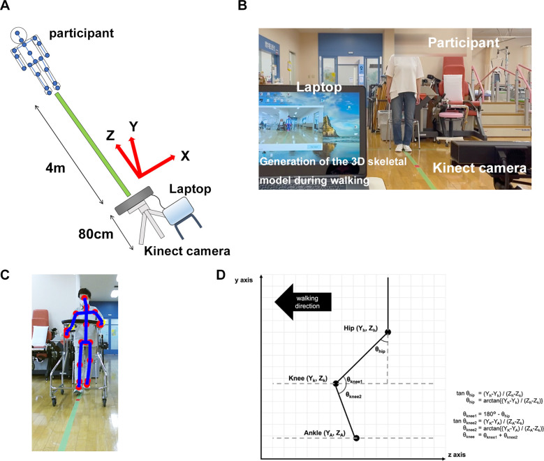 Objective gait analysis using Kinect v2® for the prognosis of walking during the acute phase of rehabilitation after proximal femoral fracture surgery.