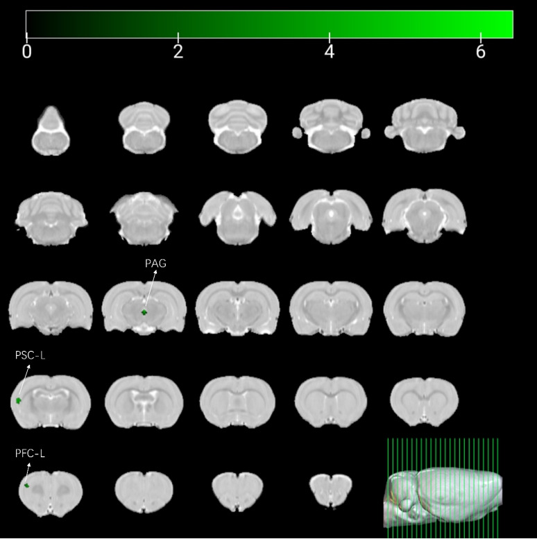 Changes in Brain Activity and Functional Connectivity During Spinal Nerve Stimulation in a Rat Model of Overactive Bladder.