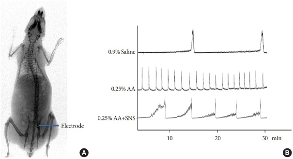 Changes in Brain Activity and Functional Connectivity During Spinal Nerve Stimulation in a Rat Model of Overactive Bladder.