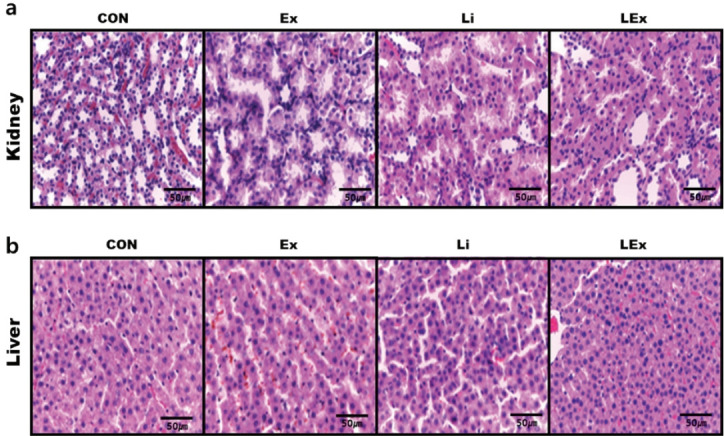Effects of low-intensity endurance exercise and low-dose lithium chloride administration on muscle atrophy in high-fat diet induced obese rats.