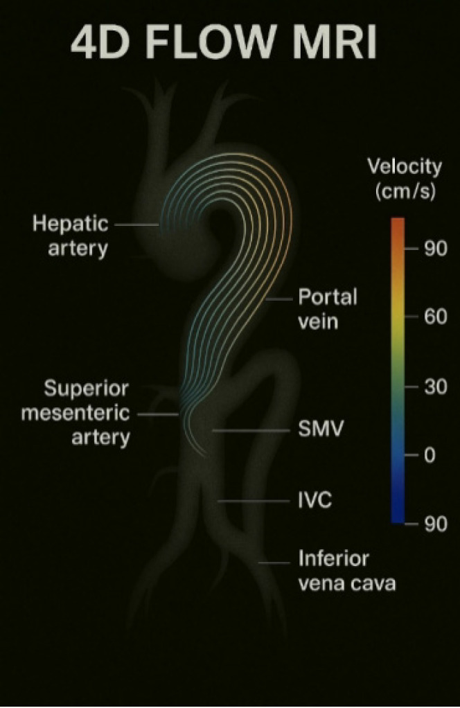 Transforming pediatric imaging: The role of four-dimensional flow magnetic resonance imaging in quantifying mesenteric blood flow.