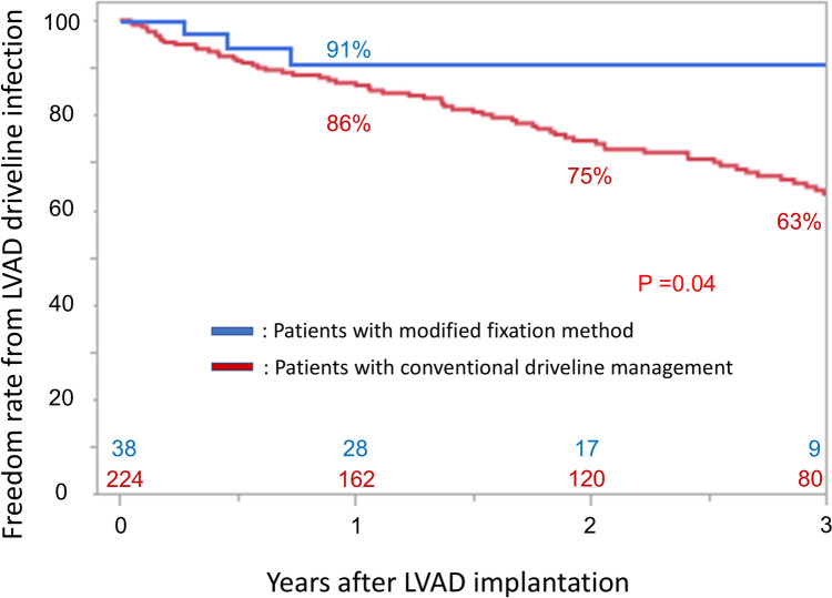 Clinical outcomes of modified left ventricular assist device driveline management.
