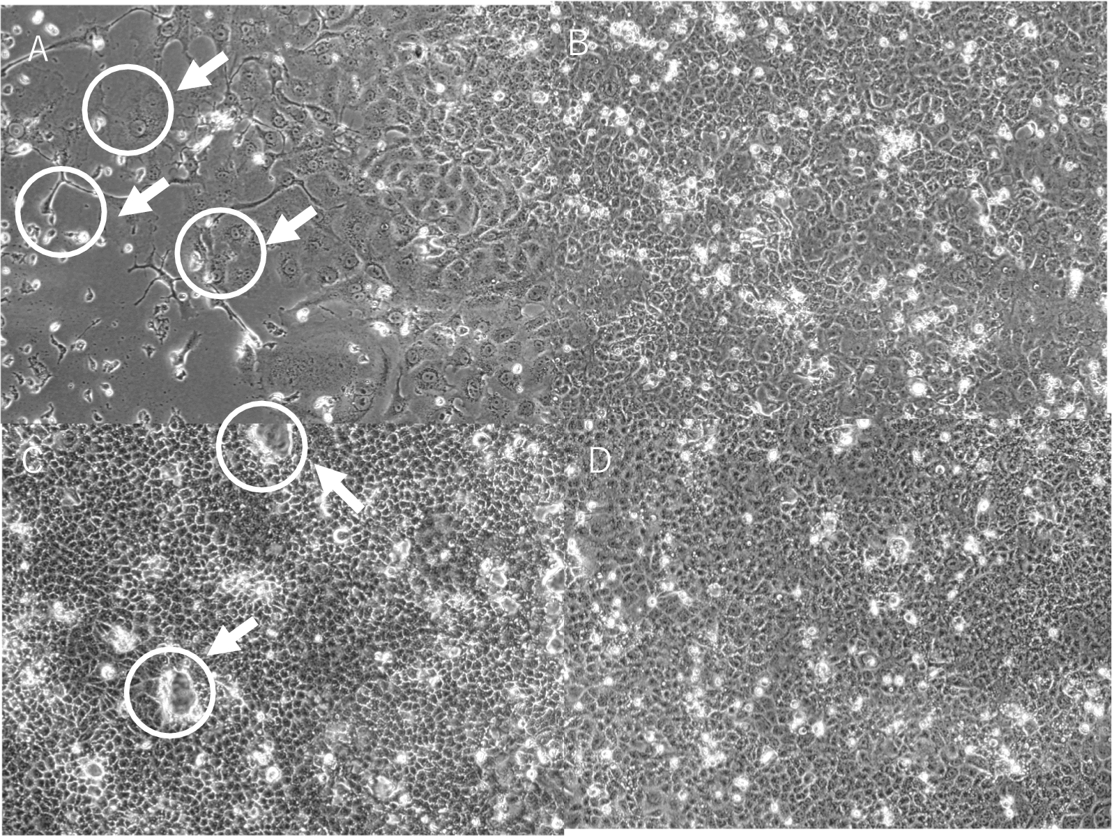 Identification of pathogens causing fever in returning travelers using next-generation sequencing.