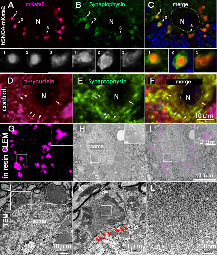 α-Synuclein-Assembled Synaptic Vesicle Pools at the Presynaptic Terminal: A Study of α-Synuclein Function Using a Novel Mouse Model.