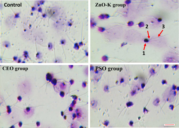 Ameliorative potential of dietary supplements, ZnO-K, citrus essential oil, and pumpkin seed oil, on sperm quality in Nile tilapia: Insights from CASA, DNA integrity, antioxidant enzymes, and gene expressions.
