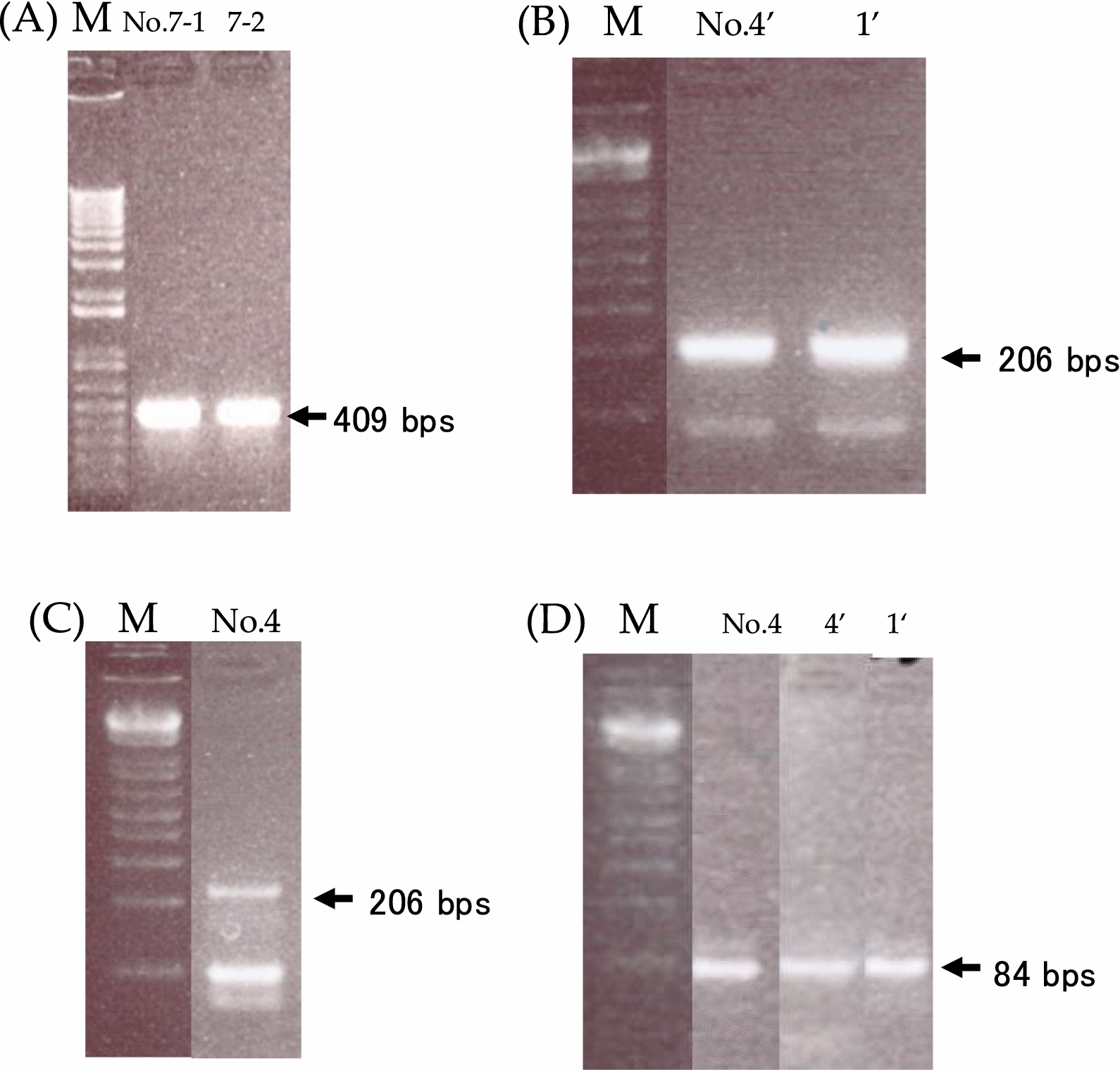Identification of pathogens causing fever in returning travelers using next-generation sequencing.