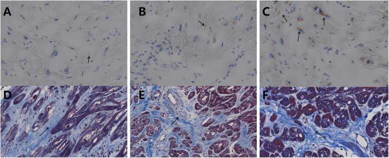 Effect of obesity on myocardial tissue characteristics in patients with hypertrophic cardiomyopathy: a cardiovascular magnetic resonance-based study.