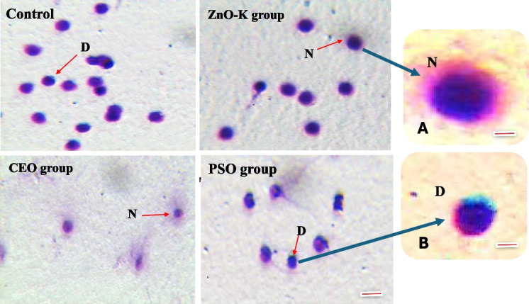 Ameliorative potential of dietary supplements, ZnO-K, citrus essential oil, and pumpkin seed oil, on sperm quality in Nile tilapia: Insights from CASA, DNA integrity, antioxidant enzymes, and gene expressions.
