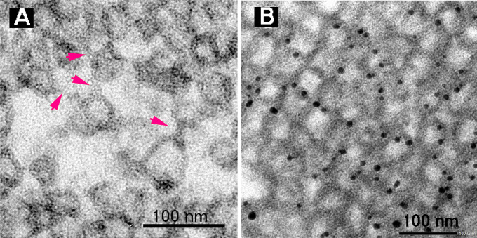 α-Synuclein-Assembled Synaptic Vesicle Pools at the Presynaptic Terminal: A Study of α-Synuclein Function Using a Novel Mouse Model.