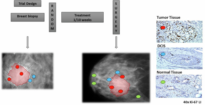 Window-of-opportunity trials to screen effective agents and optimize dose in breast cancer prevention.