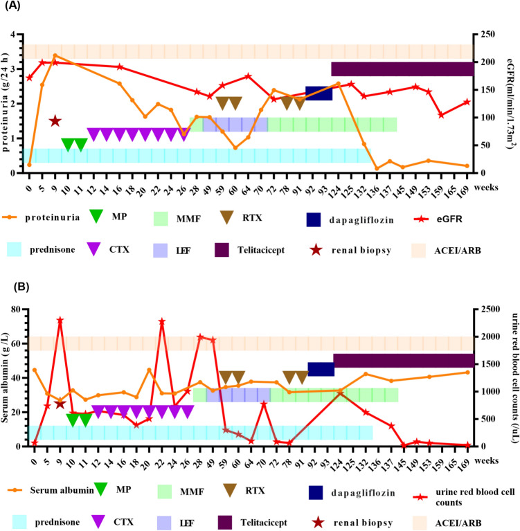 Successful outcome of a refractory IgA vasculitis nephritis in children treated with telitacicept.