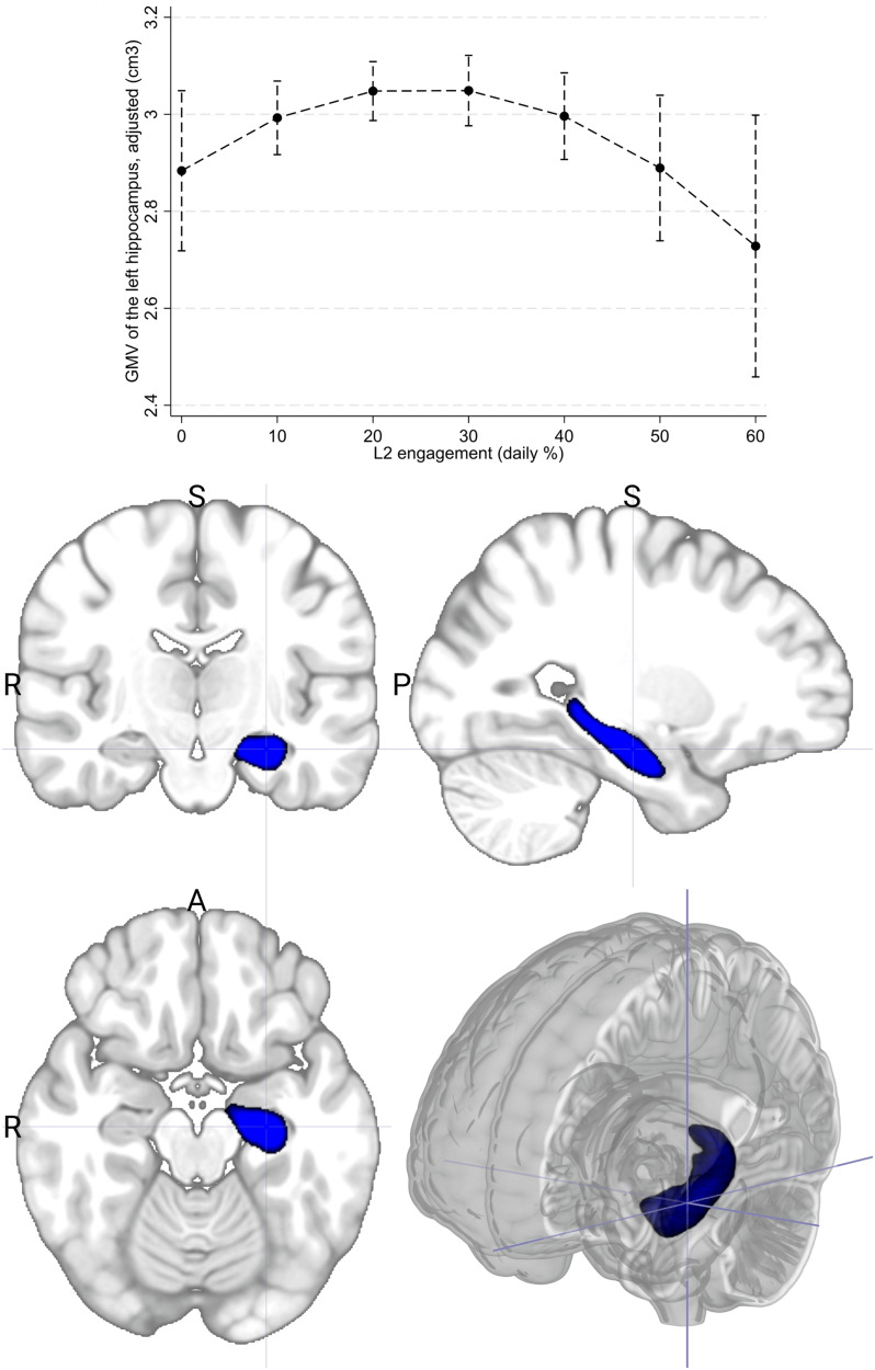 Experience-Dependent Neuroplasticity in the Hippocampus of Bilingual Young Adults.