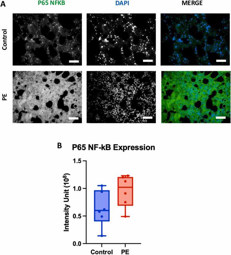 Sub-acute polyethylene microplastic inhalation exposure induced pulmonary toxicity in wistar rats through inflammation and oxidative stress.