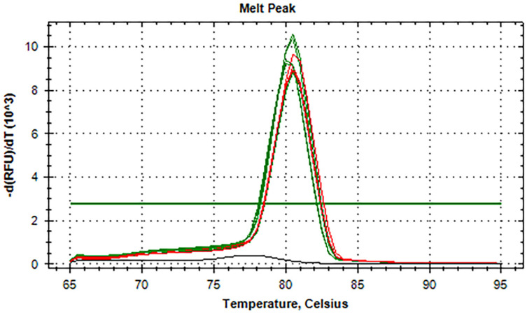 An alternative real-time fluorescence reverse transcription loop-mediated isothermal amplification assay for the rapid detection of SARS-CoV-2.