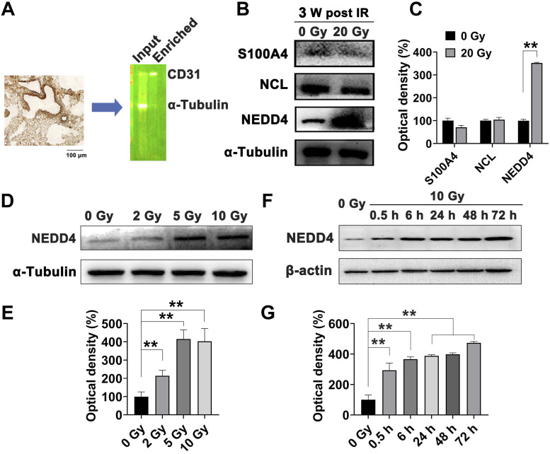NEDD4-Mediated Endothelial-Mesenchymal Transition Participates in Radiation-Induced Lung Injury Through the ATM Signaling Pathway.