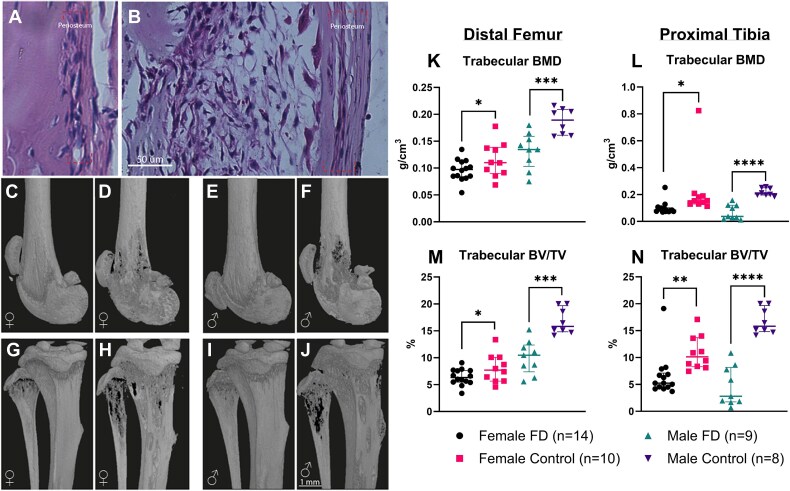 Pain in fibrous dysplasia: identifying nociceptive mechanisms in a preclinical model.