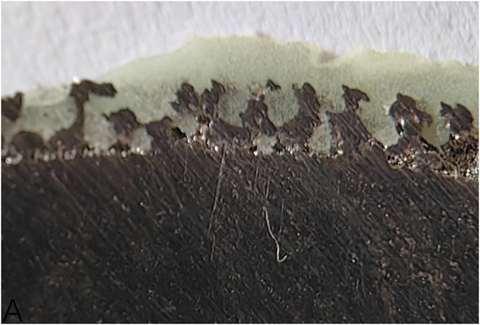 Interfacial Strength Between Porous Metal Acetabular Components and Augments.