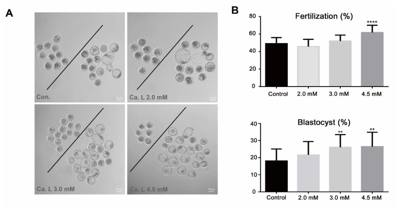 Effects of calcium lactate on in vitro fertilization and embryonic development in cattle.