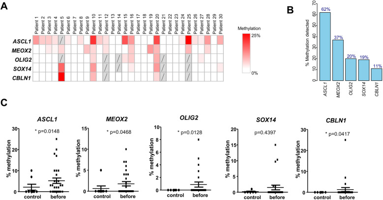 Salivary cell-free DNA methylation analysis for oncological monitoring of surgical resection of oral squamous cell carcinoma.