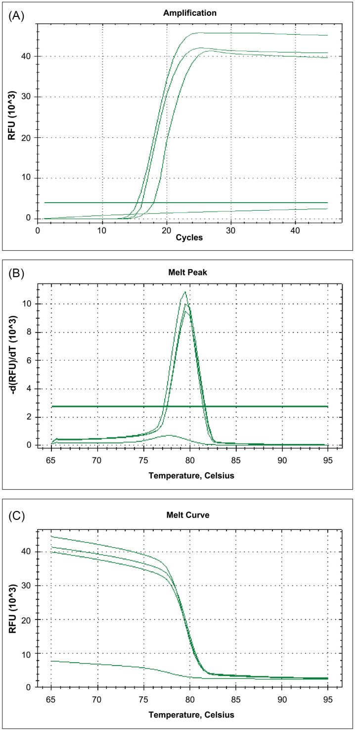 An alternative real-time fluorescence reverse transcription loop-mediated isothermal amplification assay for the rapid detection of SARS-CoV-2.